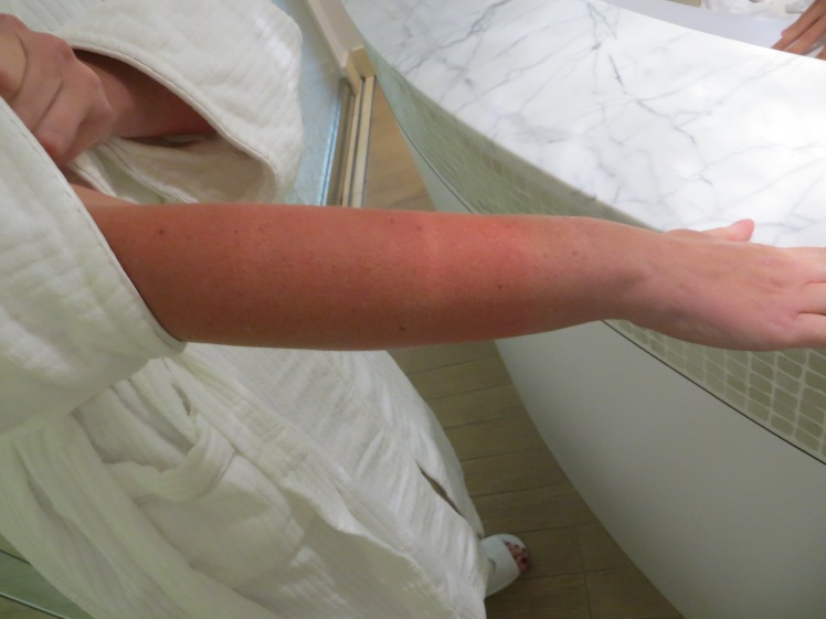 Before going into the sauna, your skin is usually around 30 degrees celsius but when you are in the cold sauna, it drops to about 5 degrees celsius.  You can see on my arm where my mittens ended.